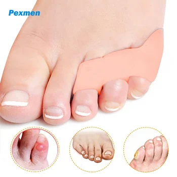 Pexmen 2 buc Degetul mic de Separare și Protecție Degetul Mic de la picior Distanțiere pentru Suprapun și Ciocan Deget de la picior Croitor Inflamație la picior Ameliorarea Durerii